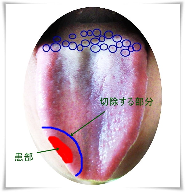 ツムツム 画面 が 大きく なる